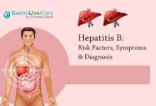 Hepatitis